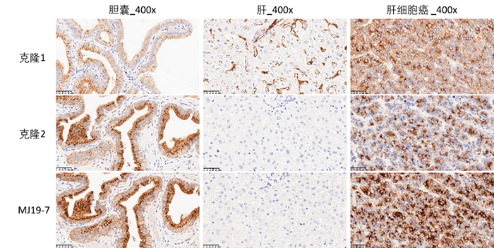 迈杰转化医学FGF19 (MJ19-7)抗体与商品化FGF19抗体的IHC染色对比